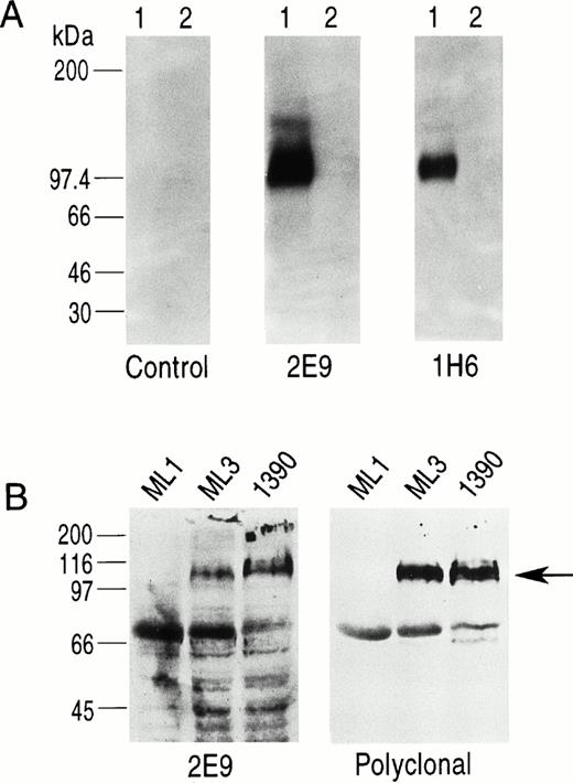 Fig. 3. (A) Western blotting study using biotinylated MoAbs 2E9 and 1H6. Lane 1 in each panel is CD34-Ig and lane 2 in each panel is a control fusion protein (CTLA4-Ig) that has the same murine IgG2A sequence as CD34-Ig. 1H6 and 2E9 recognize CD34-Ig but not CTLA4-Ig, indicating specific binding of 2E9 and 1H6 to the extracellular domain of CD34 as expressed in the fusion construct. (B) Western blots of cell lines ML1 (CD34−), ML3, and 1390 (both CD34+) using 2E9 and RPαCD34. The band for CD34 (∼110 kD) is indicated by the arrow. The other bands present on these blots were also detected in control experiments using only the second-stage reagents.