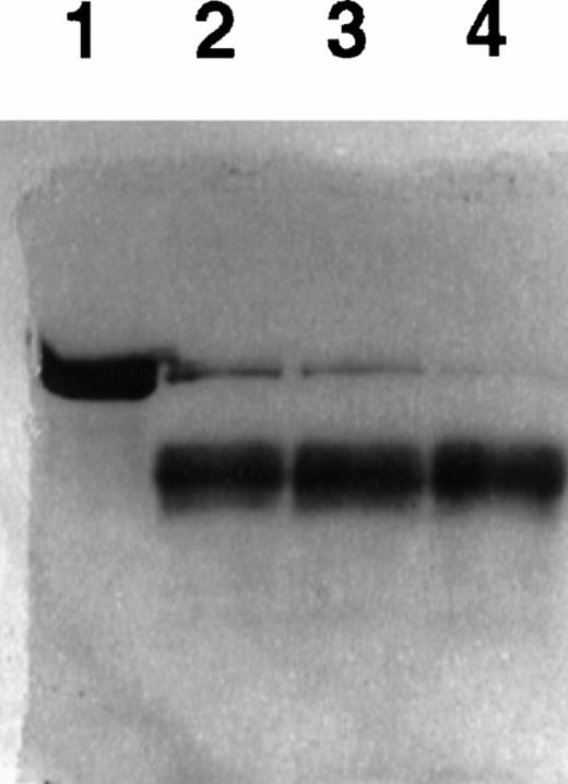 Fig. 8. TF stimulates uPA-mediated conversion of plasminogen to plasmin. Glu-plasminogen (3 μmol/L) was incubated with tcuPA (400 nmol/L) and with various concentrations of TF apoprotein for 20 minutes, and the reaction mixture was analyzed using SDS-PAGE under reducing conditions. Lane 1 contains plasminogen alone. Lanes 2 through 4 contain plasminogen, tcuPA, and increasing concentrations of TF (lane 2, 40 nmol/L TF; lane 3, 100 nmol/L TF; and lane 4, 300 nmol/L TF).