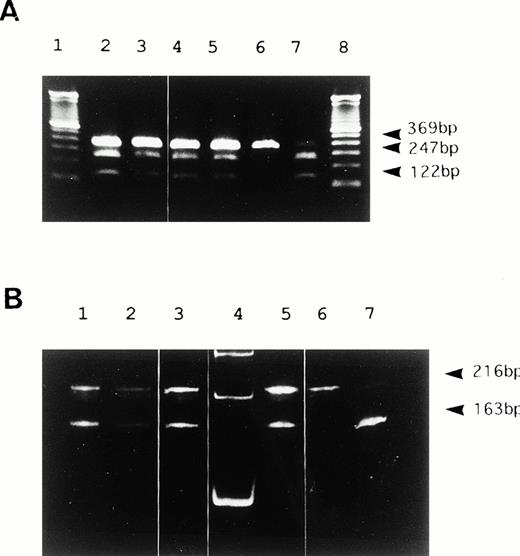 Fig. 3. Hga I restriction analysis of PCR products. (A) 2% agarose gel electrophoresis of PCR products from genomic DNA in 6 representative samples. Lanes 2 to 5 show heterozygosity for 46C/T. Lane 6 shows homozygosity for 46C. Lane 7 shows homozygosity for 46T. Undigested DNA remains as a faint 369 bp in 46C homozygotes even after a long duration of digestion. A DNA size marker (100bp ladder) was applied in lanes 1 and 8. (B) 5% polyacrylamide gel electrophoresis of RT-PCR products from liver mRNA in three genetic types for the polymorphism. Lanes 1 to 3 and 5 show heterozygosity for 46C/T. Lane 6 shows homozygosity for 46T. Lane 7 shows homozygosity for 46C. 53 bp bands digested by Hga I were barely visible in this study (not shown). A DNA size marker (100bp ladder) was applied in lane 4.