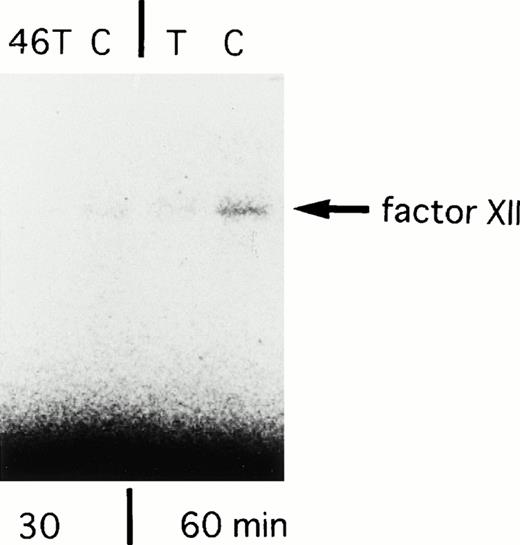 Fig. 5. SDS-PAGE analysis of in vitro translated products from 46C- and 46T-FXII cDNA. Incubation times for translation are shown in the lower portion of the panel. The arrow shows the factor XII synthesized in vitro. The experiments were repeated with essentially the same results.