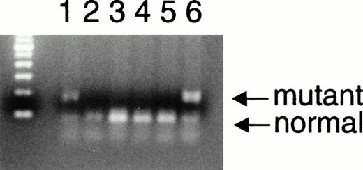 Fig. 4. Restriction digest with Mnl I. The mutation identified in Prothrombin Greenville predicts the loss of anMnl I restriction site where the sequence GAGG in the normal is the enzyme recognition site. This site is converted to AAGG in the mutant. Exon 13 for the proband and five family members was amplified by PCR and subjected to digestion with Mnl I. Hydrolysis was continued for 7 hours at 37°C. Additional enzyme was added to samples for lanes 3, 4, and 6 after 6 hours of hydrolysis to ensure complete hydrolysis. Shown are the final hydrolysis products after agarose gel electrophoresis and ethidium bromide staining. Lane numbers correspond to samples obtained from individuals shown in the pedigree (Fig 5). Shown in the lane at left is a 100-base pair ladder.