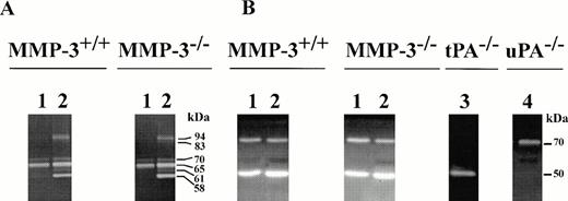 Fig. 4. Zymographic analysis on (A) gelatin- or (B) casein-containing gels of arterial extracts (5 μg total protein) obtained from MMP-3+/+ or MMP-3−/− mice without (lane 1) or 1 week after (lane 2) vascular injury. Lanes 3 and 4 in (B) represent arterial extracts obtained from t-PA−/− or u-PA−/− mice, respectively.