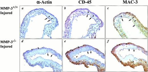 Fig. 2. Identification of different cell types in the center of the injury (position 3) 1 week after injury in MMP-3+/+(upper panel) or MMP-3−/− (lower panel) mice. Immunostaining is performed with antiserum against α-actin (panels a and d), against CD45 (panels b and e), or against Mac-3 (panels c and f). The arrows and arrowheads indicate the internal and external elastical lamina respectively (original magnification ×200).