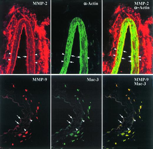 Fig. 3. Immunostaining and cellular localization of MMP-2 and MMP-9 in arterial sections (position 3) 1 week after electric injury in MMP-3+/+ mice. Single immunostaining was performed for MMP-2 or MMP-9 (appearing red) and for α-actin or Mac-3 (appearing green). Cells in which MMPs and α-actin or Mac-3 are colocalized appear yellow. The elastic membranes are visualized by their autofluorescence. The arrows and arrowheads indicate the internal and external elastical lamina respectively (original magnification ×480).