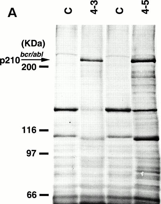 Fig. 5. Expression (A) and enhanced kinase activity (B) of the p210bcr/abl transgene product in the thymi of the two founder mice, 4-3 and 4-5 that developed ALLs. The expressed and phosphorylated p210bcr/abl transgene products are indicated by arrows and the positions of protein markers are shown on the left. The thymi of nontransgenic mice were used as negative controls (C).