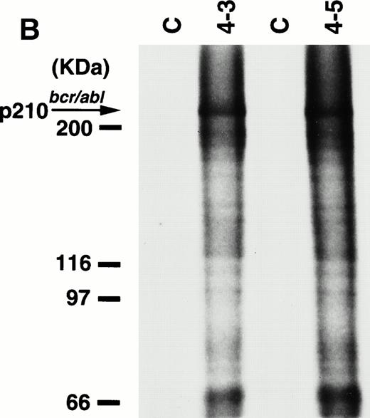 Fig. 5. Expression (A) and enhanced kinase activity (B) of the p210bcr/abl transgene product in the thymi of the two founder mice, 4-3 and 4-5 that developed ALLs. The expressed and phosphorylated p210bcr/abl transgene products are indicated by arrows and the positions of protein markers are shown on the left. The thymi of nontransgenic mice were used as negative controls (C).