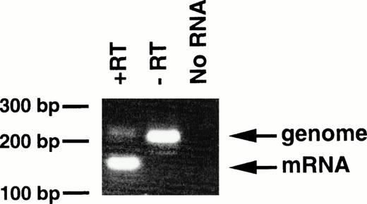 Fig. 6. Expression of bcr/abl mRNA in peripheral granulocytes of 4-5-6. The RT-PCR products generated with RT (+RT) or without RT (−RT) were electrophoresed in a 3% agarose gel and stained with ethidium bromide. Products of genomic and mRNA amplification are indicated by arrows. RT-PCR without RNA (No RNA) was also performed as a negative control. The positions of DNA markers are shown on the left.