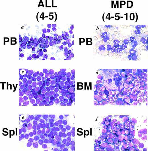 Fig. 2. WG staining of tissues from 4-5 (A, C, E) and 4-5-10 (B, D, F) that developed ALL and MPD, respectively. (A) Peripheral blood of 4-5. Massive proliferation of lymphoblasts is apparent. (B) Peripheral blood of 4-5-10. Granulocyte hyperplasia is evident. (C) Thymus of 4-5. Note the marked infiltration of lymphoblasts. (D) Bone marrow of 4-5-10. The bone marrow is hyperplastic and contains myeloid cells at various stages of differentiation. (E) Spleen of 4-5. Note infiltrating lymphoblasts. (F) Spleen of 4-5-10. Extensive infiltration of granulocytes and immature myeloid cells is apparent.