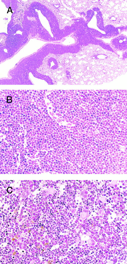 Fig. 3. HE staining of 4-5-2 that developed extramedullar crisis in the lung. (A) Lung. Massive proliferation of blast cells is apparent around the vessels. (B) Higher magnification of (A). (C) Bone marrow. In contrast to the findings for the lung, bone marrow shows a predominance of myeloid cells with megakaryocyte proliferation.