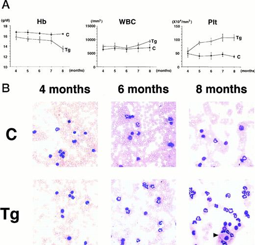 Fig. 4. (A) Comparison of hematologic parameters in the transgenic mice (Tg, ○) and nontransgenic controls (C, •) from 4 months to 8 months after birth. The data of mean values and standard deviations for groups of four mice are shown. (B) WG-stained peripheral blood smears of a transgenic mouse (Tg) and a nontransgenic control (C) at 4, 6, and 8 months after birth. A cell morphologically resembling megakaryocyte is indicated by an arrowhead. (C) Family tree derived from a founder mouse, 4-5. Circles and squares indicate female and male mice, respectively. Transgenic or nontransgenic mice are shown as transgene + or −. Mice that died of leukemia are shown as • or ▪.