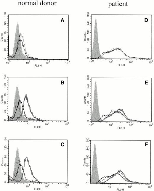 Fig. 2. The effect of cross-linking FcγRI or FcγRII on total cellular IL-6 protein production by PMNs. Flow cytometry histograms depict total intracellular IL-6 protein in freshly isolated PMNs from a normal donor (A through C) or PMNs from a patient treated with rhG-CSF in vivo (D through F). In each panel, the solid histogram presents isotype control staining. In (A) and (D), the histograms depict fluorescence staining of freshly isolated PMNs in media (—) and staining of PMNs after exposure to cross-linker alone (···). In (B) and (E), the histograms depict fluorescence staining of PMNs after incubation with media (—) or with (Fab′)2 32.2 anti-FcγRI (···). In (C) and (F), the histograms depict fluorescence staining of PMNs after incubation with media (—) or with Fab′ IV.3 (···). In (B), (C), (E), and (F), the bold line depicts staining after cross-linking anti-FcγRI or anti-FcγRII as listed above. This experiment is representative of four virtually identical experiments.