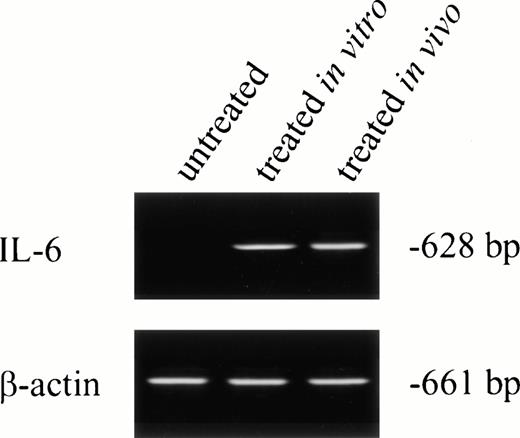 Fig. 3. IL-6 mRNA expression by PMNs analyzed by RT-PCR. Total cellular RNA was isolated from purified PMNs from a normal donor (the PMNs were maintained in culture media for 24 hours before RNA extraction; lane 1), PMNs from a normal donor treated for 24 hours in vitro with rhG-CSF (lane 2), or PMNs from a patient treated with rhG-CSF in vivo (lane 3). RNA was reverse-transcribed and PCR-amplified using IL-6–specific primers as described in the Materials and Methods. RNA integrity was checked using β-actin primer. This is a representative gel from four experiments performed.