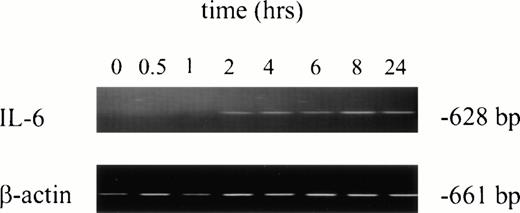 Fig. 4. Kinetics of IL-6 mRNA expression after in vitro rhG-CSF stimulation. Purified PMNs from a normal donor were treated in vitro for 30 minutes to 24 hours with 10 ng/mL rhG-CSF. Total cellular RNA was isolated, reverse-transcribed, and PCR-amplified using IL-6–specific primers as described in the Materials and Methods. RNA integrity was evaluated in all experiments using β-actin primers. This is a representative gel from four experiments performed. The trend of IL-6 mRNA induction after rhG-CSF treatment was consistent across all donors evaluated with minor variations in the time of rhG-CSF stimulation necessary before seeing detectable IL-6 mRNA.
