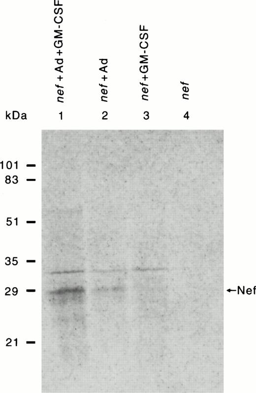 Fig. 2. Detection of HIV-1 Nef expression in HMØs after Ad-d1312–mediated transfection of nef cDNA. HMØs were transfected either with nef cDNA alone or cDNA conjugated with transferrin-poly(L-lysine) in the presence of a replication-deficient AD, dl312. HMØs were cultured in macrophage media in the presence of IL-3 (5 ng/mL) and GM-CSF (20 ng/mL). After 4 days in culture, cells were transfected and cultured in macrophage media containing FBS, IL-3, with/without GM-CSF for 24 hours. The cells were then labeled with 200 μCi/mL of 35 S-labeled cysteine/methionine for 4 hours after starving them with cysteine/methionine-free media for 1 hour. Cells were then harvested, lysed, and immunoprecipitated with Nef antibody followed by SDS-PAGE and autoradiography. HMØs transfected with nef, AD, dl312, and lipofectamine in the presence of GM-CSF had the highest levels of Nef expression (lane 1). The absence of GM-CSF markedly reduced Nef expression (lane 2). The absence of Ad from the transfection resulted in minimal Nef expression in the presence of GM-CSF (lane 3) or in the absence of GM-CSF (lane 4).