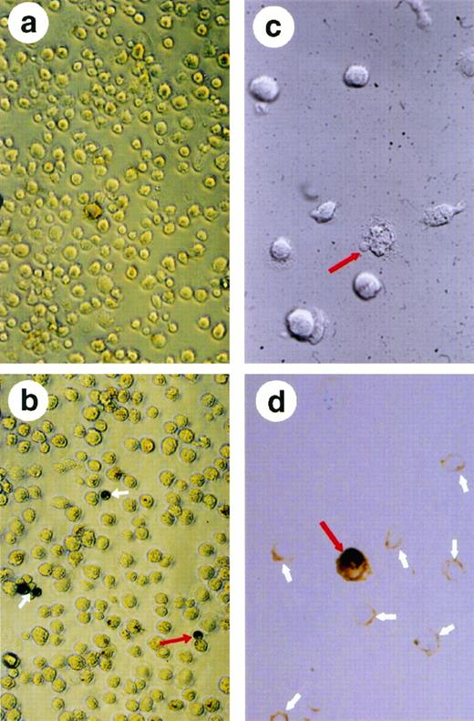 Fig. 5. Analysis of the β-gal-positive cells after transfection of HMØs with β-gal and nef cDNA conjugated with transferrin-poly (L-lysine). A replication-deficient AD, dl312 was added to mediate HIV-1 nef and β-gal transfection. The transfected MØs were washed and resuspended in PBS; the resuspended cells were then placed in a poly(L-lysine)-coated 96-well plate, fixed, and stained for β-gal. The experiment was repeated four times and a representative field is shown. (a) shows the nontransfected HMØs that are negative in β-gal staining. (b) shows HMØs transfected with AD, dl312 and the β-gal plasmid. Fields were chosen to show distinct β-gal staining. Positive cells are blue and are shown with white arrows. A dividing MØ with positive β-gal staining is indicated with a red arrow. Microscopic examination of apoptotic cells identified by condensation of cytoplasm and chromatin in HMØs transfected with HIV-1 nef (c and d). MØs were cultured on slide chambers after transfection; cells were fixed in 10% neutral-buffered formalin and stained with the ApopTag peroxidase kit. A red arrow shows unstained apoptotic cells with blebbing (c). A single stained apoptotic cell (red arrow) and many unstained nonapoptotic cells (white arrows) are shown in (d).