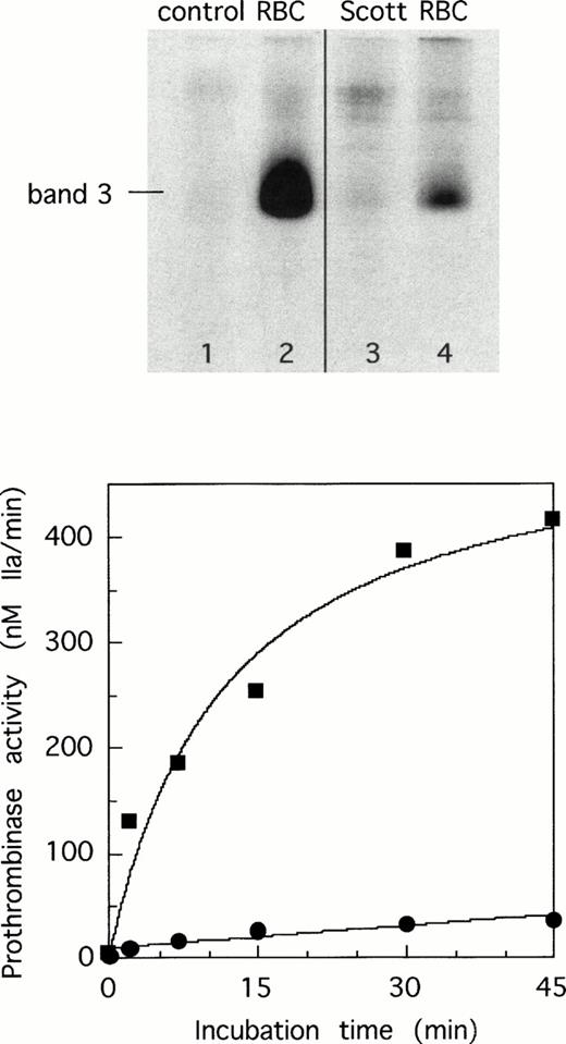 Fig. 1. Tyrosine phosphorylation of membrane proteins and development of prothrombinase activity in normal erythrocytes and erythrocytes from Scott syndrome incubated with Ca2+-ionomycin. Washed cells were incubated with ionomycin in the presence of Ca2+ as described in Materials and Methods, and samples were taken at 15 minutes for analysis of tyrosine phosphorylation and at various time intervals for measuring prothrombinase activity as a measure for surface exposed phosphatidylserine. Phosphorylation patterns in red blood cells did not appreciably change on varying the incubation time from 5 to 30 minutes. Upper panel: normal erythrocytes in the absence (lane 1) and presence of Ca2+-ionomycin (lane 2) and Scott erythrocytes in the absence (lane 3) and presence of Ca2+-ionomycin (lane 4). Lower panel: time course of appearance of prothrombinase activity in normal (▪) and Scott erythrocytes (•).