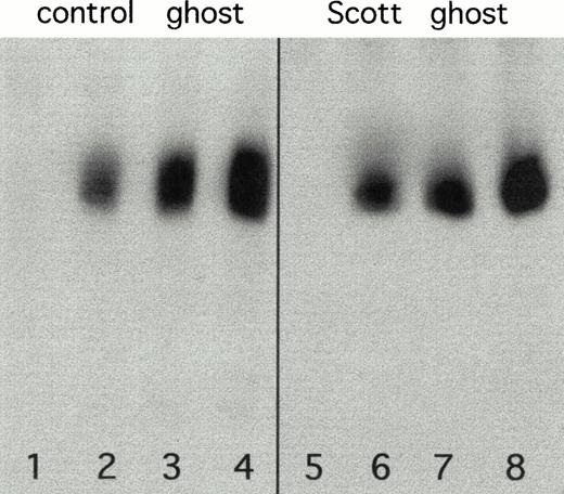 Fig. 2. Western blots showing tyrosine phosphorylation in control (lanes 1 to 4) and Scott erythrocyte ghosts (lanes 5 to 8) after a 15-minute incubation period with increasing concentrations of ATP: 0.05 mmol/L (lanes 1 and 5); 0.5 mmol/L (lanes 2 and 6); 1.0 mmol/L (lanes 3 and 7) and 2.0 mmol/L (lanes 4 and 8).