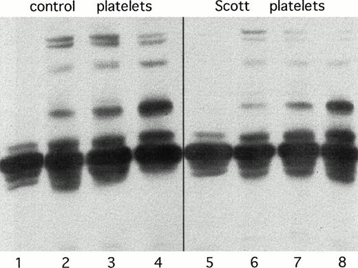 Fig. 4. Tyrosine phosphorylation in normal (lanes 1 to 4) and Scott syndrome platelets (lanes 5 to 8). Lanes 1 and 5 represent unstimulated platelets; lanes 2 and 6, platelets stimulated with 4 nmol/L thrombin; lanes 3 and 7, platelets treated with 70 nmol/L thapsigargin and subsequently activated with 4 nmol/L thrombin; lanes 4 and 8, platelets activated with 10 μg/mL collagen.