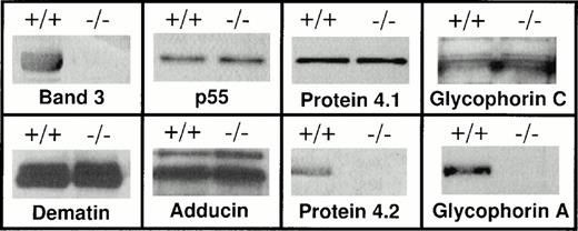 Fig. 1. Western blot analysis of the red blood cell membrane proteins. Red blood cells were collected from both band 3 +/+ and band 3 −/−mice and washed in PBS. Ghosts were prepared by lysis as described in Materials and Methods. Ghosts membranes were solubilized and analyzed by sodium dodecyl sulfate-polyacrylamide gel electrophoresis (SDS-PAGE). After transfer to nitrocellulose, Western blot analysis was performed using the ECL chemiluminescence kit as suggested by the manufacturer. Both band 3 +/+ and band 3 −/− red blood cell membranes contain protein 4.1, glycophorin C, p55, dematin, and adducin, while the complete absence of protein 4.2 and GPA is noted. The GPA panel shows the position of the dimer. No monomeric GPA was detected (data reviewed, but not shown). It should be noted that each membrane fraction used for Western blotting was isolated from the same number of normal and band 3 −/− red blood cells. However, a more precise quantitative method such as enzyme-linked immunosorbent assay (ELISA) will be required to compare the absolute amounts of membrane proteins in normal and band 3 null red blood cells.