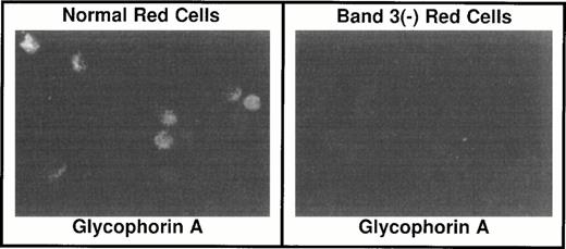 Fig. 2. Immunocytochemistry of red blood cells. Red blood cells from band 3 +/+ and band 3 −/− mice were fixed onto Alcian Blue-coated coverslips with 4% paraformaldehyde. After permeabilization of the cells in a PBS solution containing 0.1% Triton-X 100 and blocking in a PBS solution with 1.0% bovine serum albumin and 1.0% goat serum, the cells were incubated with a rabbit antibody raised against the cytoplasmic domain of human GPA. The signal was detected with a goat antirabbit/rhodamine-conjugated secondary antibody. In contrast to band 3 +/+ red blood cells, band 3 −/−red blood cells do not display any detectable level of GPA on their surface.