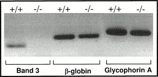 Fig. 3. RT-PCR of mRNA isolated from spleen erythropoietic cells. Total RNA was isolated from the spleens of normal and band 3 null mice as described in Materials and Methods. cDNA was synthesized using random hexamer primers and M-MLV reverse transcriptase. Specific GPA primers were used to amplify a small fragment of the GPA cDNA. Small segments of band 3 and β globin cDNA were also amplified as negative and positive controls, respectively. The results confirm the presence of GPA mRNA indicating that the transcription of the gene takes place in band 3 −/− erythroblasts.