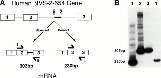 Fig. 2. A diagram and RT-PCR results showing aberrant splicing of the human βIVS-2-654 transcript in theHbbth-4/Hbb+ thalassemic mice. (A) The diagram shows the human βIVS-2-654 gene with aberrantly spliced β globin mRNA produced from the mutant gene compared with the correctly spliced β globin mRNA that would have been produced from a wild-type gene. The thick line between nucleotides 580 and 652 shows the region of IVS-2 that is maintained in the βIVS-2-654 mRNA. RT-PCR primers i and ii are shown at the location and in the direction in which they anneal to the RNA. Primer i anneals to sequences within the second exon of human β globin, and primer ii anneals to sequences within the third exon of human β globin. (B) An autoradiograph of polyacrylamide gel electrophoresis of RT-PCR with primers i and ii on RNA from a heterozygous huβ s/Hbb+mouse (lane 1), a heterozygousHbbth-4/Hbb+ thalassemic mouse (lane 2), a HeLa cell line transfected with a βIVS-2-654 gene (lane 3), and a normal human (lane 4) is shown. Aberrantly spliced β globin mRNA and correctly spliced β globin mRNA RT-PCR products are 303 bp and 230 bp, as labeled.