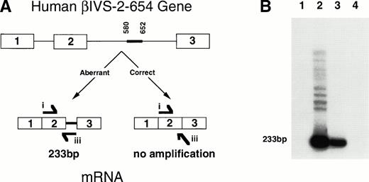 Fig. 3. A diagram and RT-PCR results showing aberrant splicing as seen in humans of the human βIVS-2-654 transcript in theHbbth-4/Hbb+ thalassemic mice. (A) The diagram shows the human βIVS-2-654 gene with aberrantly spliced β globin mRNA produced from the mutant gene compared with the correctly spliced β globin mRNA that would have been produced from a wild-type gene. The thick line between nucleotides 580 and 652 shows the region of IVS-2 that is maintained in the βIVS-2-654 mRNA. RT-PCR primer i and iii are shown at the location and in the direction in which they anneal to the RNA. Primer i anneals to sequences within the second exon of human β globin, and primer iii anneals to two bases of the sequence at the end of the second exon and 29 bases of the region of the second intron that is maintained with this mutation in humans. (B) An autoradiograph of polyacrylamide gel electrophoresis of RT-PCR with primers i and iii on RNA from a heterozygous huβs/Hbb+ mouse (lane 1), a heterozygous Hbbth-4/Hbb+ thalassemic mouse (lane 2), a HeLa cell line transfected with a βIVS-2-654 gene (lane 3), and a normal human (lane 4) is shown. Aberrantly spliced β globin mRNA RT-PCR product is 233-bp, as labeled. Correctly spliced β globin mRNA does not amplify with primers i and iii.