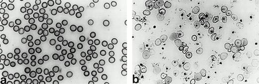 Fig. 4. Peripheral blood smears from wild-type and heterozygousHbbth-4/Hbb+ mice. Blood smears stained with Wright stain from (a) a wild-type 129/Ola mouse and (b) an F1 heterozygous Hbbth-4/Hbb+thalassemic mouse (600X).