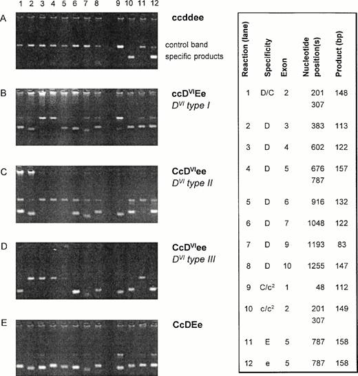 Fig. 1. PCR-SSP of DVI samples. Agarose gels of representative DVI samples are shown along with negative and positive controls. The specificities of the 12 reactions for the RHD/RHCE exons are shown on the right side (box). The nucleotide position(s) detected by the PCR-SSP are given along with the expected sizes of the specific products. The control band represents a 434-bp product of the growth hormone gene. For DVI samples, three different reaction patterns are observed: pattern I (B) lacks specific signals for RHD exons 4 and 5 and is compatible with DVI type I.19 Pattern II (C) lacks those for RHD exons 4 to 6 being compatible with DVI type II.18 Pattern III (D) lacking specific products forRHD exons 3 to 6 is novel. c2 indicates the c(cyt48) allele.