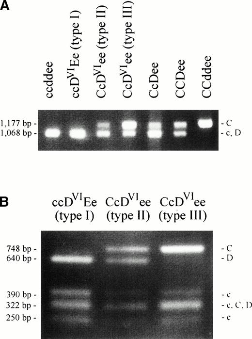 Fig. 2. PCR-RFLP of intron 2 of the Rhesus genes. An intron 2 polymorphism was analyzed by PCR amplification and digestion by PstI as previously described.25 Agarose gels are shown with fragment lengths25 and fragment specificities indicated. (A) The 1,177-bp product is specific for RHCalleles, the 1,068-bp product is representative for RHD orRHc or both. The CcDVIee type III sample shows a strong band at the RHC position and a weaker band at theRHD/RHc position. In contrast, the CcDVIee type II and the CcDee samples show a weak band at RHC position and a strong band at the RHD/RHc position. (B) The PCR products shown in (A) were digested with PstI to separate RHD fromRHc-specific products. The DVI type III sample lacks the RHD-specific fragment (640 bp), whereas all other RhD positive samples show this fragment.