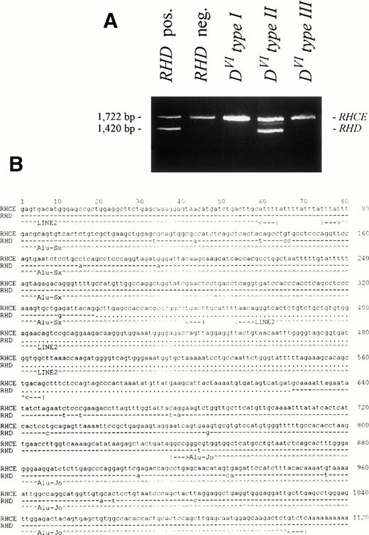 Fig. 6. Intron 3 length polymorphism of the Rhesus genes. The 3′ region of intron 3 was amplified by PCR using primers RB46 and RB5. (A) The agarose gel shows a 1,722-bp product for theRHCE gene. The 1,420-bp product is representative of theRHD gene. In the DVI type II sample, aRHD-specific product is found. DVI type Iand DVI type III samples show noRHD-specific product. (B) The nucleotide sequence of the 3′ part of intron 3 of the RHCE gene starting 1,556 nucleotides 5′ from exon 4 and of the corresponding parts of theRHD gene comprising the diagnostic 288 bp deletion are shown. Dashes denote nucleotides in the RHD gene that are identical, dots denote deletions. Nucleic acid sequence accession numbers were Z97030(RHCE; 1,580 bp) and Z97031 (RHD; 1,278 bp).