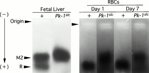 Fig. 3. PAGE and staining for PK activity in extracts of fetal livers or RBCs. Fetal livers were obtained from 16-day embryos of CBA-+/+ or -Pk-1slc/Pk-1slc mice; RBCs from 1-day-old and 7-day-old CBA-+/+ or -Pk-1slc/Pk-1slc mice. M2, M2-PK; R/L, R- or L-PK.