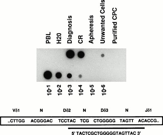 Fig. 1. Detection of MRD by PCR analysis of V δ 1-J δ 1 junction of the TCR δ gene in a T-ALL patient. DNA samples were extracted from bone marrow aspirates performed at the onset of the disease (Diagnosis), at the end of induction chemotherapy when it was considered in complete hematologic remission (CR), from unmanipulated G-CSF mobilized CPC obtained after a consolidation course with high dose chemotherapy (Apheresis), from cells coated by anti-CD2 and -CD7 magnetic microbeads and retained within the depletion column (Unwanted cells), from the purified T-cell depleted fraction of circulating progenitor cells (Purified CPC), and from the peripheral blood lymphocytes of a normal donor (PBL). The sensitivity of the PCR reaction was checked by serial log dilution of the patient's DNA obtained at diagnosis with DNA from a normal donor (lower lane of the figure). PCR products were blotted onto nylon membranes and hybridized with the indicated clonospecific probe labeled with (γ -32 P) ATP.
