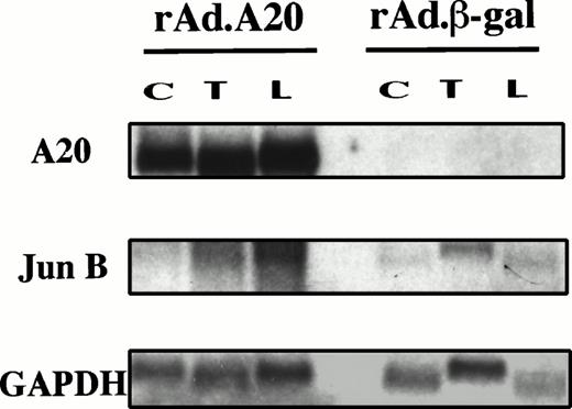 Fig. 4. Induction of the non–NF-κB–dependent gene junB is not inhibited by expression of A20. PAEC were infected and stimulated as in (A) with TNF (T) and LPS (L), and RNA was extracted. Steady-state mRNA levels of A20, junB, and GAPDH were evaluated by Northern blot analysis as described in (A) using a junB cDNA probe shown to cross-react with its porcine homologue. Results show that the proto-oncogene junB is inducible in rAd.A20-infected PAEC, following TNF and LPS stimulation. The level of induction was even greater than that seen in the rAd.β-gal–infected PAEC, although this difference was not significant when corrected for GAPDH.