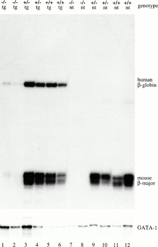 Fig. 3. EKLF is required for β-globin–transgene expression in the fetal-adult stage. Fourteen-and-a-half–day fetal liver RNA was isolated from μD14 transgenic (tg) animals or nontransgenic (nt) litter mates with the EKLF genotype indicated at the top of each lane. The RNA was analyzed by RNase protection using a human β-globin and a mouse β-major probe. The RNA was also simultaneously analyzed with a GATA-1 probe as a loading control. The position of the protected fragments are indicated to the right of the figure.