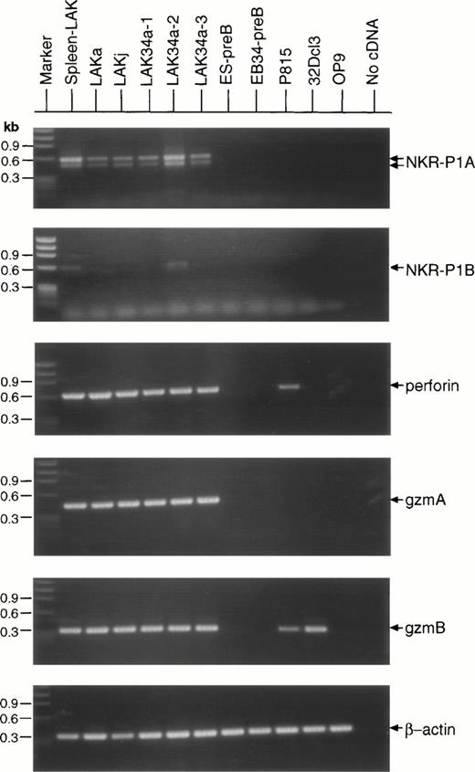 Fig. 6. Expression of NK cell-specific mRNAs in the CD34+ EB cell–derived and ES cell–derived LAK cells. RT-PCR analysis was performed with total RNAs extracted from the C57BL/6 mouse spleen-LAK cells, type I LAK (LAKa, LAKj, LAK34a-1, and LAK34a-3) cells, type II LAK (LAK34a-2) cells, ES-pre-B cells, EB34-pre-B cells, P815 cells, 32Dcl3 cells, and OP9 cells, and analyzed on 1.2% agarose gels. The first lane is for size standard, and the rightmost lane is a negative control for cDNA. Results of the 2× 20-cycle amplification with different set of primers for NKR-P1A (top), NKR-P1B, granzyme A (gzm A), granzyme B (gzm B), perforin, and β-actin (bottom) genes are shown.