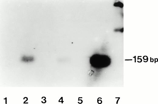 Fig. 1. Assessment of HTLV-II proviral DNA in TF-1 cell line by PCR amplification of a tax gene sequence. TF-1 cells treated with HTLV-II Mo strain derived from C344 T cells (lanes 3 and 5) or BJAB cells (lanes 2 and 4) were cultured for 3 days (lanes 4 and 5) or 7 days (lanes 2 and 3). DNA was extracted, amplified, and electrophoresed. Detection of the amplified product was performed by using a tax specific probe. Lane 1, negative control (untreated TF-1 cells); lane 6, positive control represented by PCR-amplified DNA from C344 T cells; lane 7, molecular weight markers.
