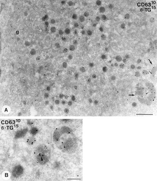 Fig. 1. Demonstration of β-TG and CD63 in cultured megakaryocytes. Immunogold double-labeling as indicated on the figure. (A) Specific labeling of β-TG is demonstrated in the Golgi complex (g), α-granules, and MVB II (arrows). Colocalization with CD63 (arrowheads) is restricted to the MVBs. (B) Detailed demonstration of colocalization of β-TG with CD63 in a MVB II. Note that the labeling of CD63 is associated with membranes of the internal vesicles and that of β-TG with the matrix. Bars A, 500 nm; B, 200 nm.