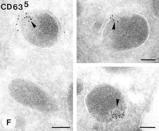 Fig. 4. Multivesicular bodies and α-granules in human platelets. Modified pick up approach applied to thin frozen sections as described in Materials and Methods. (A and B) Methyl cellulose sucrose pick up after immuno-gold labeling with a nonspecific control antibody and protein-A gold. (C and D) “direct-view” method. (E and F) Immunolabeling as indicated on the figure. The arrow in (B) indicates an α-granule containing internal vesicles at the periphery. Inset: Higher magnification of an α-granule with eccentrically located internal vesicles. (D) Arrowheads indicate peripheral intragranular vesicles. (E) Immunolabeling of vWF using 10 nm protein-A gold. Gold labeling is located at the eccentric rims of the α-granules. Arrowheads indicate two internal vesicles ≈ 40 nm in diameter. (F) Demonstration of CD63 in platelet α-granules using 5 nm protein-A gold. Arrowheads indicate CD63 associated with internal vesicles, which are often located at extended tips of the α-granules. MVB, multivesicular body, α, α-granules. Bars, 100 nm.