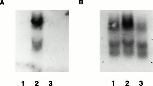 Fig. 6. Demonstration of mRNA expression in transgenic mice by Northern blot. (A) RNA from wild-type mouse bone marrow (lane 1) and transgenic line F0 no. 16 bone marrow (lane 2) and spleen (lane 3) probed with radiolabeled β-gal probe. The major expected 5-kb upper band is shown, along with a lower cross-hybridizing band of uncertain origin. In (B), the same blot is shown as in (A), after it was stripped and reprobed with control mouse β-actin cDNA probe. Several bands hybridizing to the β-actin probe are present in each lane, allowing relative quantification of the amounts of hybridizable RNA in each lane.