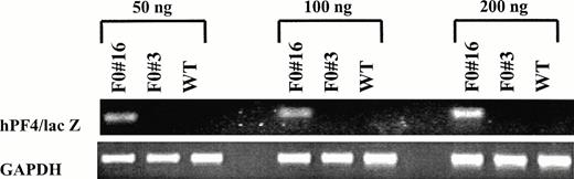 Fig. 7. Semiquantitative RT-PCR analysis of −245 hPF4/lacZ expression in bone marrow RNA. Increasing amounts of total input RNA (50, 100, and 200 ng) from bone marrow of transgenic (F0no. 16 and F0 no. 3) and wild-type (WT) mice were reverse transcribed and amplified for 25 cycles. The PCR products for the −245 hPF4/lacZ (164 bp) and GAPDH primers (392 bp13) were visualized by ethidium bromide staining with 2% agarose gels.