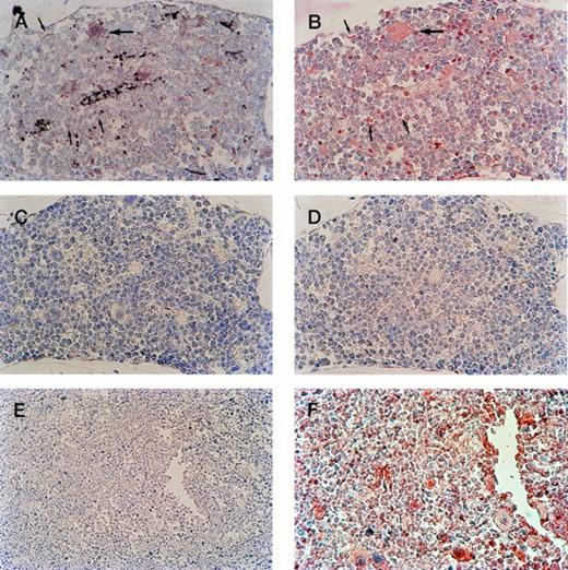 Fig. 4. Serial sections of bone marrow from transgenic progeny of F0 no. 16 show megakaryocyte-specific β-gal expression. (A) In the bone marrow of transgenic mice, positive megakaryocyte staining by IGSS (brown color) is shown. Hematoxylin counterstaining provides the nuclear blue staining. (B) 4A5-labeled (red stained) bone marrow shows the location of immature and mature megakaryocytes. Comparison of (A) and (B) documents transgene expression in all identifiable immature (small arrows) and mature (large arrows) megakaryocytes. (C) IGSS negative control; IGSS staining of transgenic mouse without primary antibody shows absence of brown color. (D) 4A5 negative control; 4A5 staining of transgenic mouse without primary antibody shows absence of red color. (Original magnification × 400). (E, F) Nontransgenic negative control; IGSS (E, wider field under lower magnification) and 4A5 (F) staining of the bone marrow of a wild-type mouse under identical conditions as (A) and (B), respectively. IGSS is negative, whereas 4A5 is positive as expected.