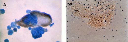 Fig. 5. β-gal staining of megakaryocyte and platelets. (A) Close-up of positive megakaryocyte. (B) Platelets seen in a cross-section of a blood vessel from bone marrow of an F0no. 16 mouse. The unstained cells are red blood cells (anucleuate) and white blood cells (blue nuclei). Original magnification × 400.
