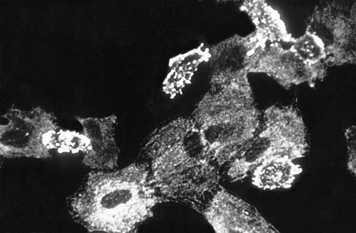 Fig. 6. Immunofluorescent localization of GAS6 in resting and PAF stimulated EC. EC on glass coverslips were treated for 10 minutes without (upper panel) or with (lower panel) PAF (10−7mol/L), fixed, permeabilized, immunostained as described in Materials and Methods, and observed using a laser scanning confocal microscope. Frames taken at 1-μm intervals along the Z axis were merged to obtain reconstructed images (600× final magnification).