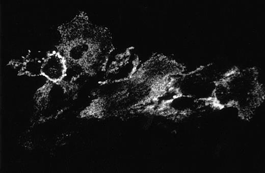 Fig. 6. Immunofluorescent localization of GAS6 in resting and PAF stimulated EC. EC on glass coverslips were treated for 10 minutes without (upper panel) or with (lower panel) PAF (10−7mol/L), fixed, permeabilized, immunostained as described in Materials and Methods, and observed using a laser scanning confocal microscope. Frames taken at 1-μm intervals along the Z axis were merged to obtain reconstructed images (600× final magnification).