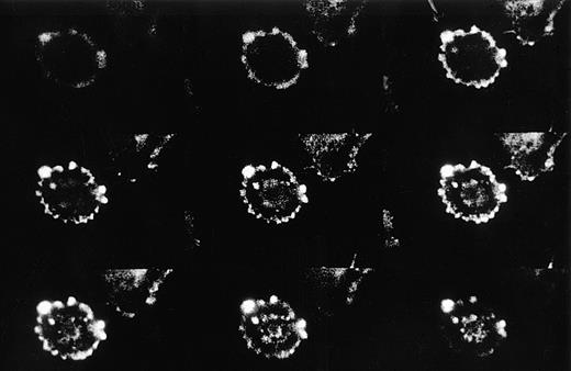 Fig. 7. Perimembrane localization of GAS6 in a resting EC. EC on glass coverslips were fixed, permeabilized, and immunostained as described in Materials and Methods. The individual frames obtained following confocal microscopy analysis of 1-μm intervals along the Z axis are progressively depicted from left to right and top to bottom. The first frame refers to the section taken at the glass attachment. One typical example is shown.