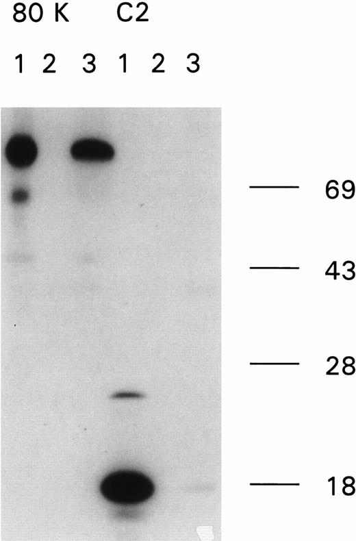 Fig. 1. Immunoprecipitation of recombinant factor VIII fragments with antibodies present in the inhibitor plasma. Recombinant factor VIII fragments corresponding to the factor VIII light chain (80K), the C2 domain (C2), the factor VIII heavy chain (90K), and the A2 domain (A2) were expressed in High Five cells and metabolically labeled as described.26 Binding of antibodies to the metabolically labeled factor VIII fragments was assessed by immunoprecipitation. Bound proteins were eluted and analyzed under reducing conditions on a 10% (wt/vol) SDS-polyacrylamide gel. (A) Reactivity of anti-factor VIII antibodies with factor VIII light chain fragments. Lane 1, CLB-CAg 117; lane 2, control plasma; lane 3, antibodies present in patient's plasma. (B) Reactivity of antibodies with factor VIII heavy chain fragments. Lane 1, CLB-CAg 9; lane 2, control plasma; lane 3, antibodies present in patient's plasma. (C) Subclass determination of anti-factor VIII antibodies. Binding of anti-factor VIII antibodies to metabolically labeled factor VIII light chain was performed using subclass specific antibodies. Lane 1, total IgG; lane 2, IgG1; lane 3, IgG2; lane 4, IgG3; lane 5, IgG4. Molecular weight markers are given at the right of the figure.