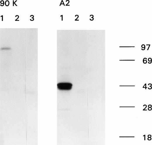 Fig. 1. Immunoprecipitation of recombinant factor VIII fragments with antibodies present in the inhibitor plasma. Recombinant factor VIII fragments corresponding to the factor VIII light chain (80K), the C2 domain (C2), the factor VIII heavy chain (90K), and the A2 domain (A2) were expressed in High Five cells and metabolically labeled as described.26 Binding of antibodies to the metabolically labeled factor VIII fragments was assessed by immunoprecipitation. Bound proteins were eluted and analyzed under reducing conditions on a 10% (wt/vol) SDS-polyacrylamide gel. (A) Reactivity of anti-factor VIII antibodies with factor VIII light chain fragments. Lane 1, CLB-CAg 117; lane 2, control plasma; lane 3, antibodies present in patient's plasma. (B) Reactivity of antibodies with factor VIII heavy chain fragments. Lane 1, CLB-CAg 9; lane 2, control plasma; lane 3, antibodies present in patient's plasma. (C) Subclass determination of anti-factor VIII antibodies. Binding of anti-factor VIII antibodies to metabolically labeled factor VIII light chain was performed using subclass specific antibodies. Lane 1, total IgG; lane 2, IgG1; lane 3, IgG2; lane 4, IgG3; lane 5, IgG4. Molecular weight markers are given at the right of the figure.