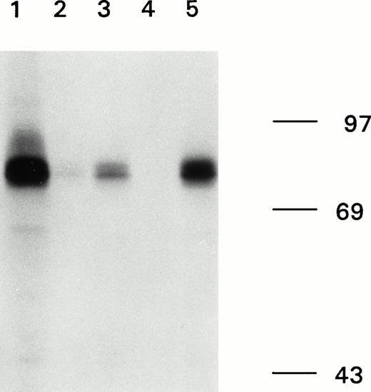 Fig. 1. Immunoprecipitation of recombinant factor VIII fragments with antibodies present in the inhibitor plasma. Recombinant factor VIII fragments corresponding to the factor VIII light chain (80K), the C2 domain (C2), the factor VIII heavy chain (90K), and the A2 domain (A2) were expressed in High Five cells and metabolically labeled as described.26 Binding of antibodies to the metabolically labeled factor VIII fragments was assessed by immunoprecipitation. Bound proteins were eluted and analyzed under reducing conditions on a 10% (wt/vol) SDS-polyacrylamide gel. (A) Reactivity of anti-factor VIII antibodies with factor VIII light chain fragments. Lane 1, CLB-CAg 117; lane 2, control plasma; lane 3, antibodies present in patient's plasma. (B) Reactivity of antibodies with factor VIII heavy chain fragments. Lane 1, CLB-CAg 9; lane 2, control plasma; lane 3, antibodies present in patient's plasma. (C) Subclass determination of anti-factor VIII antibodies. Binding of anti-factor VIII antibodies to metabolically labeled factor VIII light chain was performed using subclass specific antibodies. Lane 1, total IgG; lane 2, IgG1; lane 3, IgG2; lane 4, IgG3; lane 5, IgG4. Molecular weight markers are given at the right of the figure.