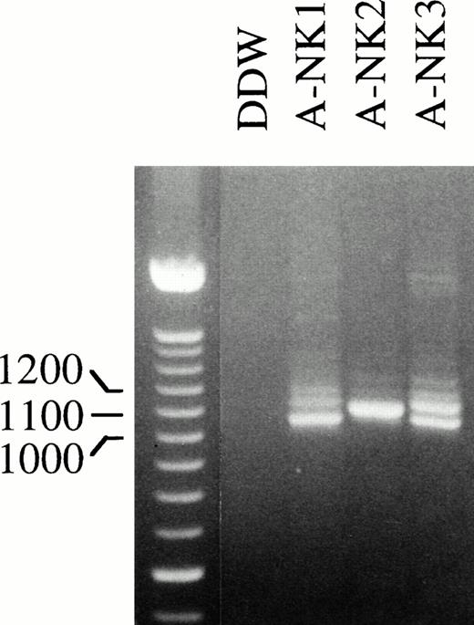 Fig. 4. Full-length FcγRIIc-specific RT-PCR analysis of NK cell RNA. RNA isolated from the indicated human A-NK cell preparations was reverse transcribed and PCR amplified with an FcγRIIc-specific primer pair that would generate full-length products and further analyzed on an EtBr containing 2% agarose gel. The 100-bp DNA ladder was used as a size marker.